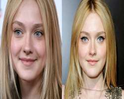 Dakota Fanning before surgery